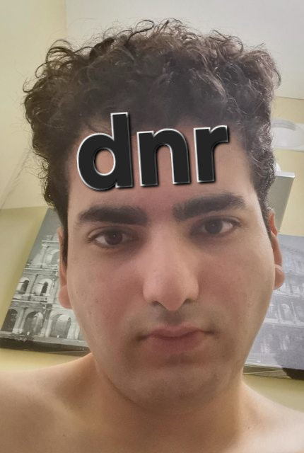 1000004278