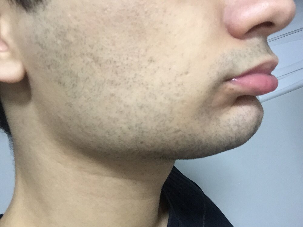 IMG 0591