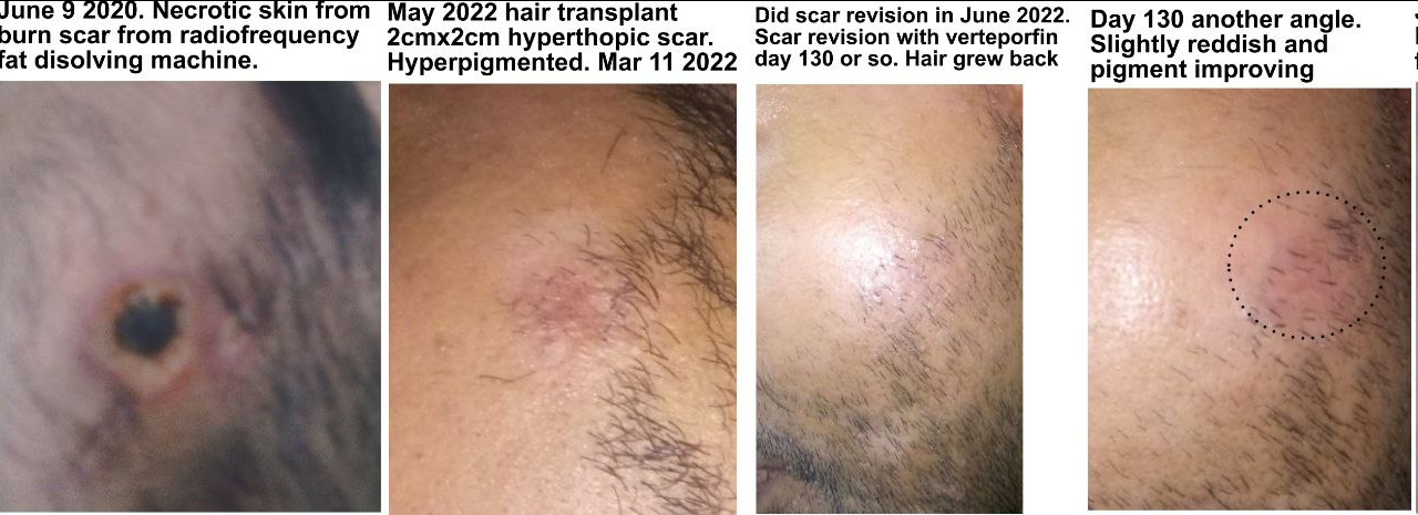 1711156350763