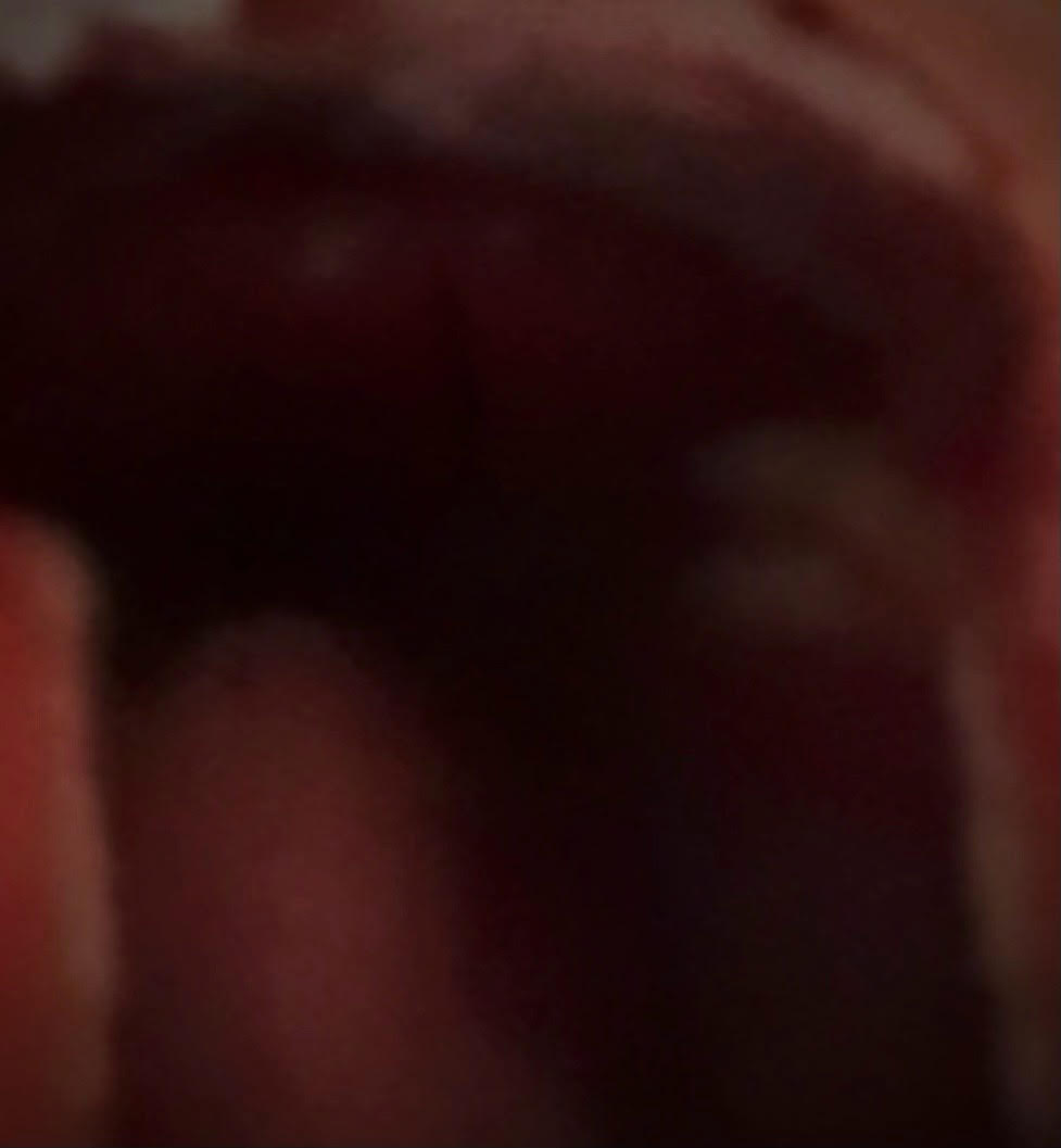 Mouth2