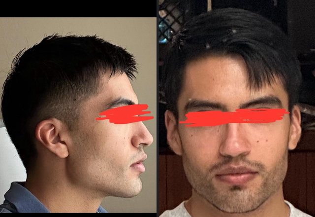 25AE74D9 1440 4400 A6D8 F9F2C9373A6E