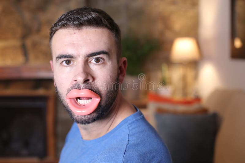 Man huge lip fillers man huge lip fillers 207260472