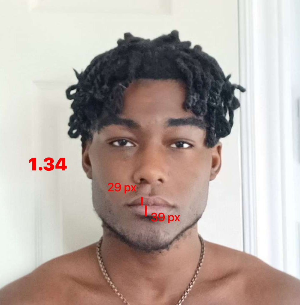 Lowerliptoupperlip13