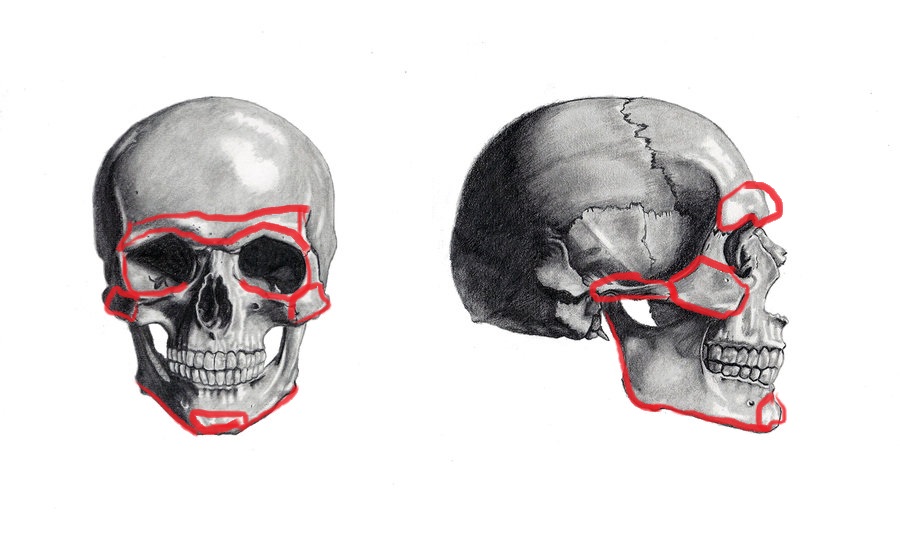 Skull