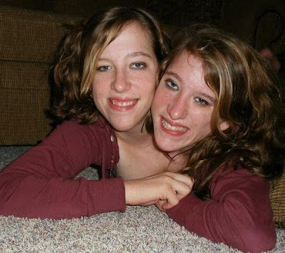 The two headed girls would've been ideal if they were stacies ...
