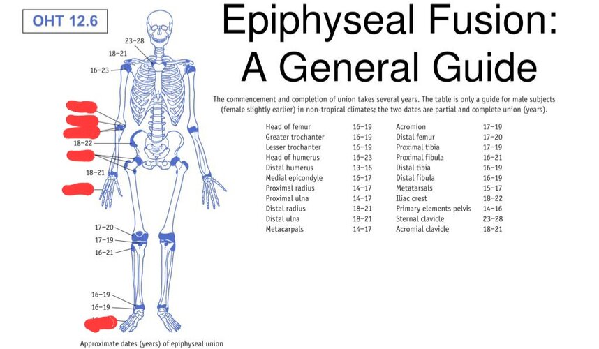 what_causes_epiphyseal_fusion.jpg