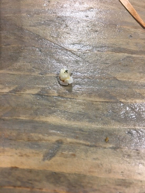 Broken tooth as a result