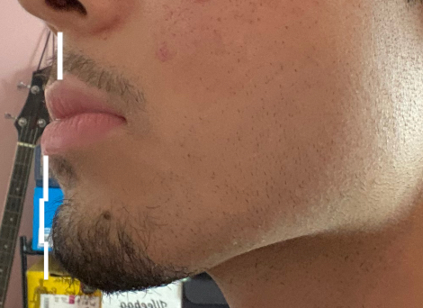IMG 2336