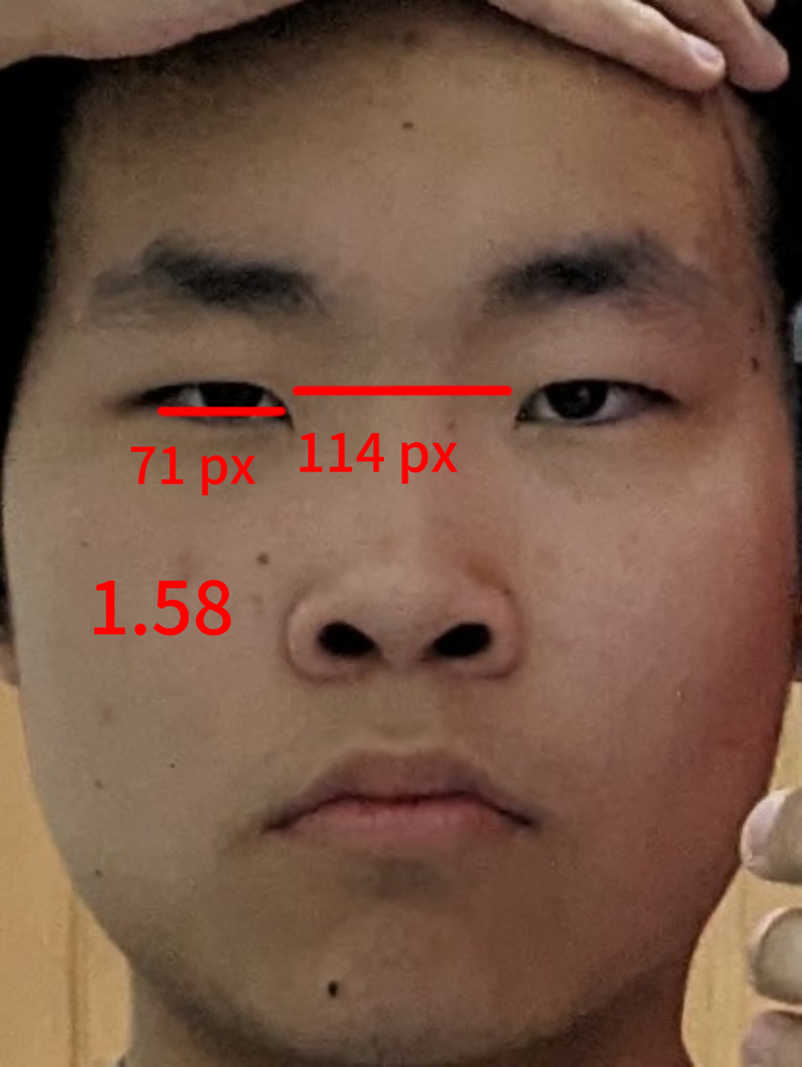 1000003316