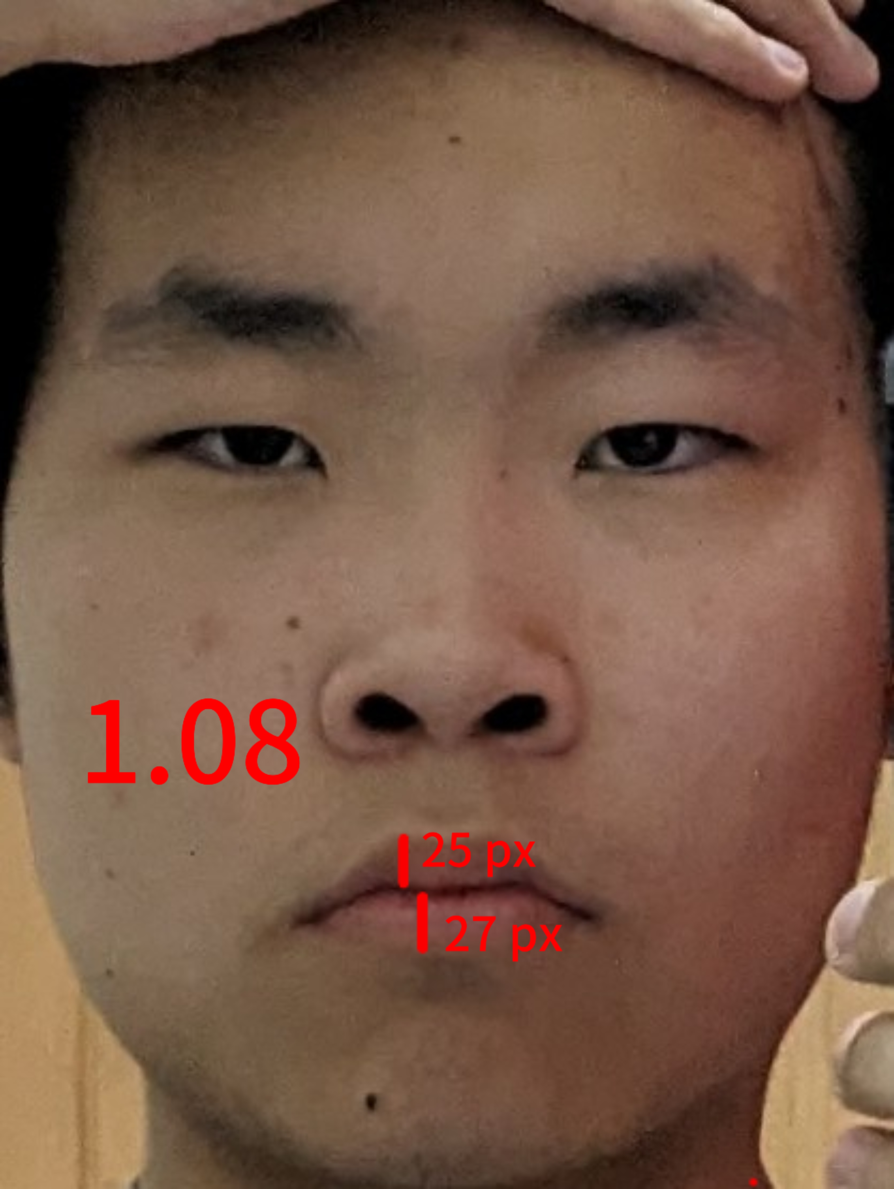 1000003320