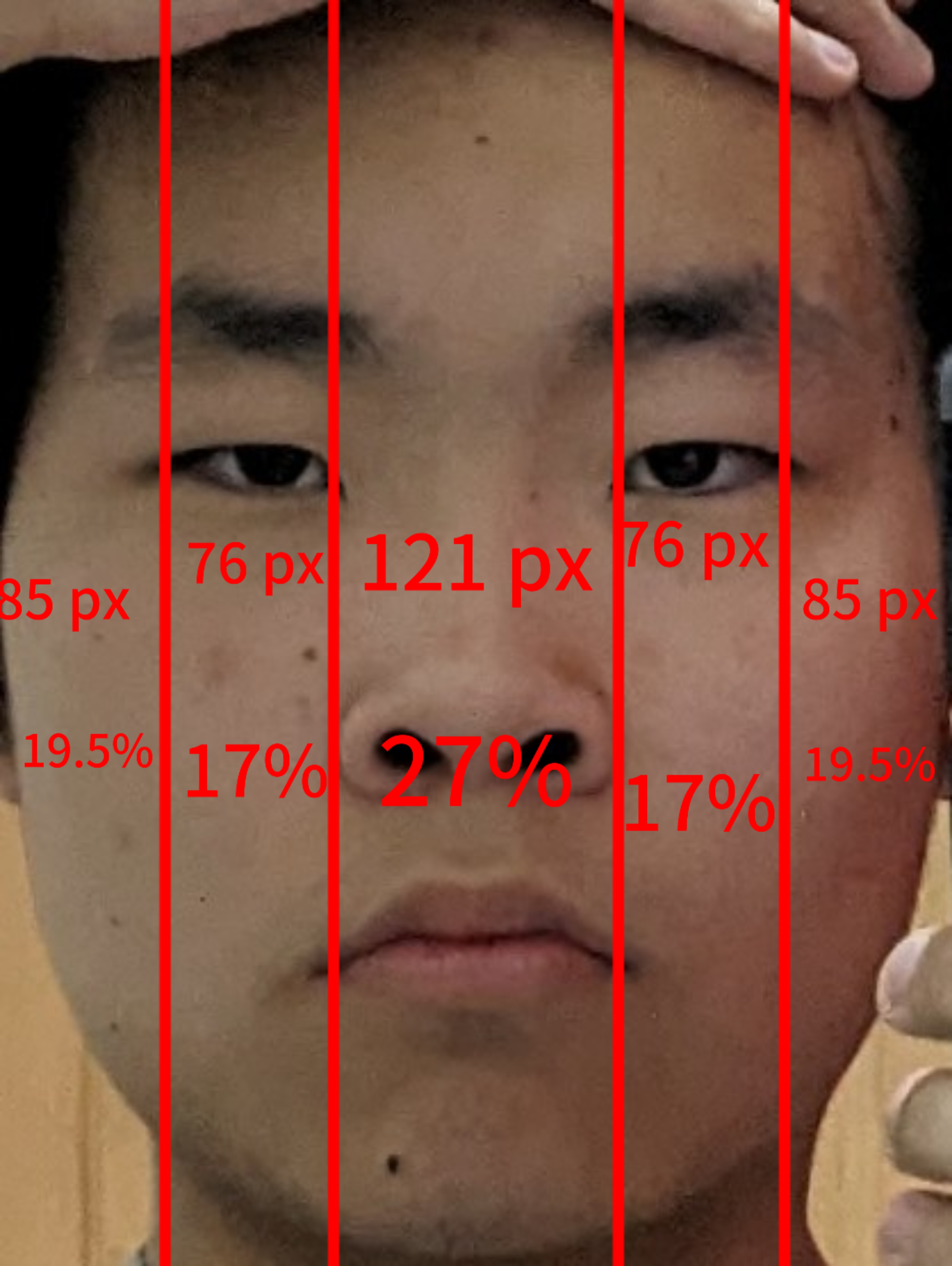 1000003155.png