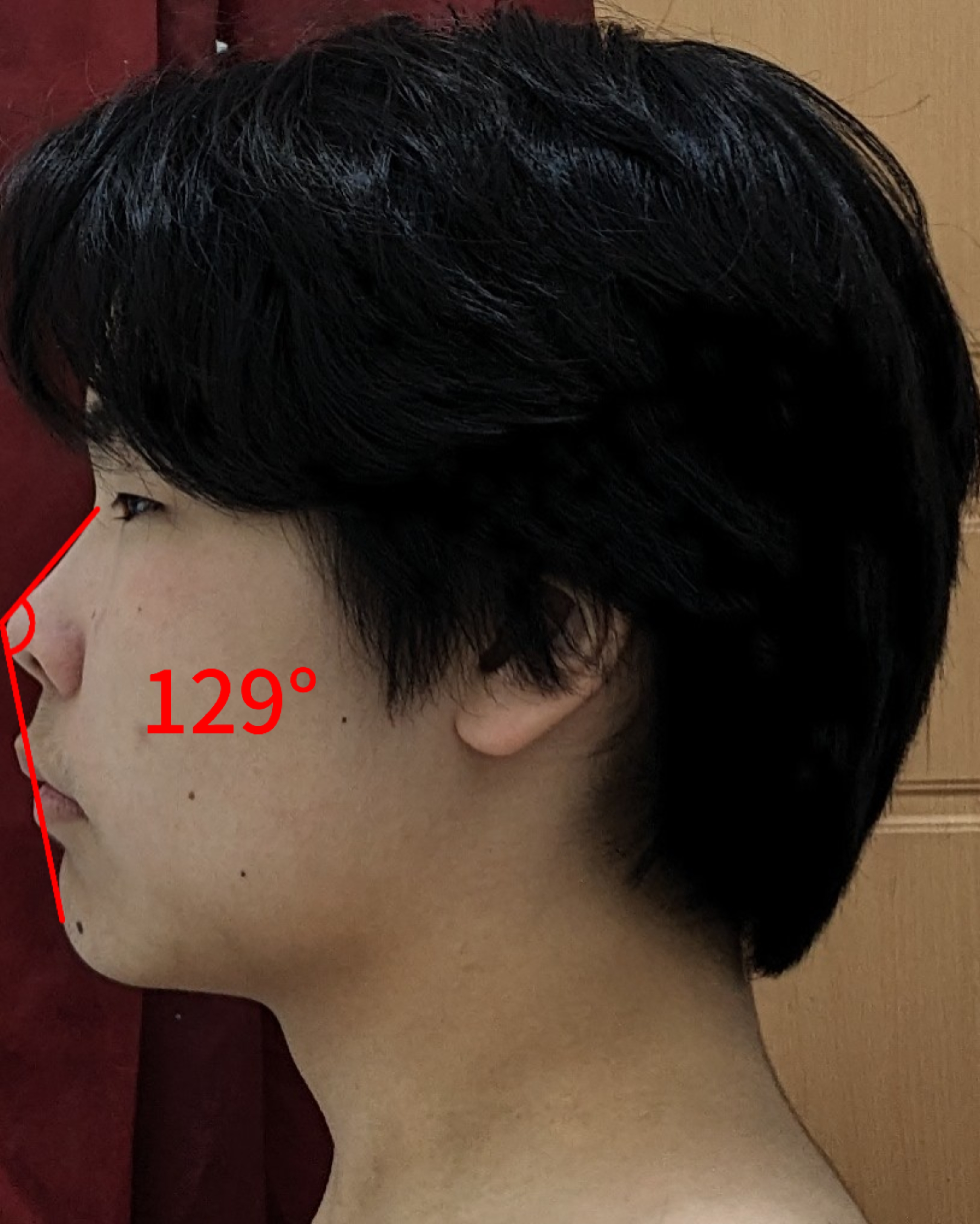 1000003352