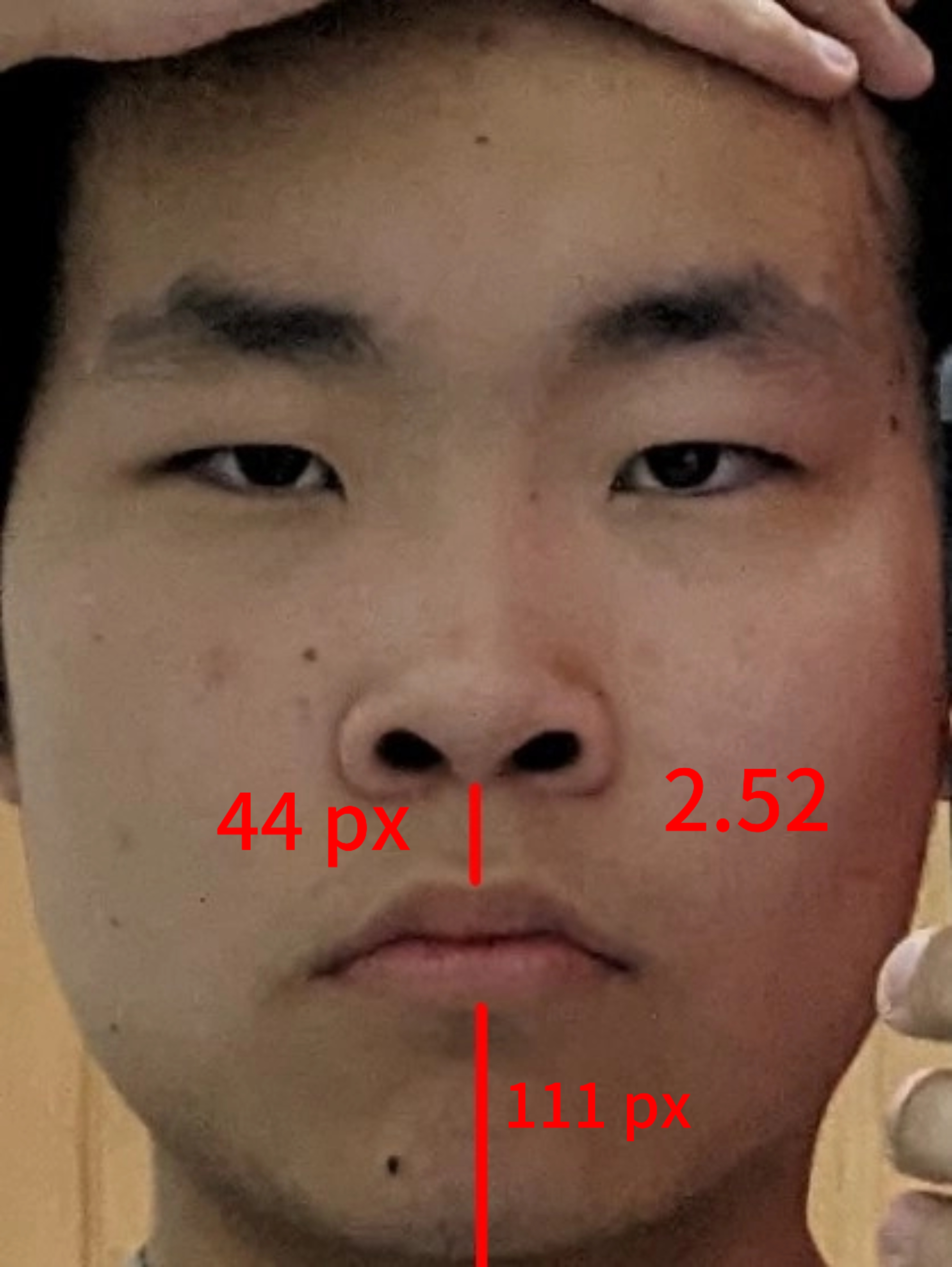 1000003251