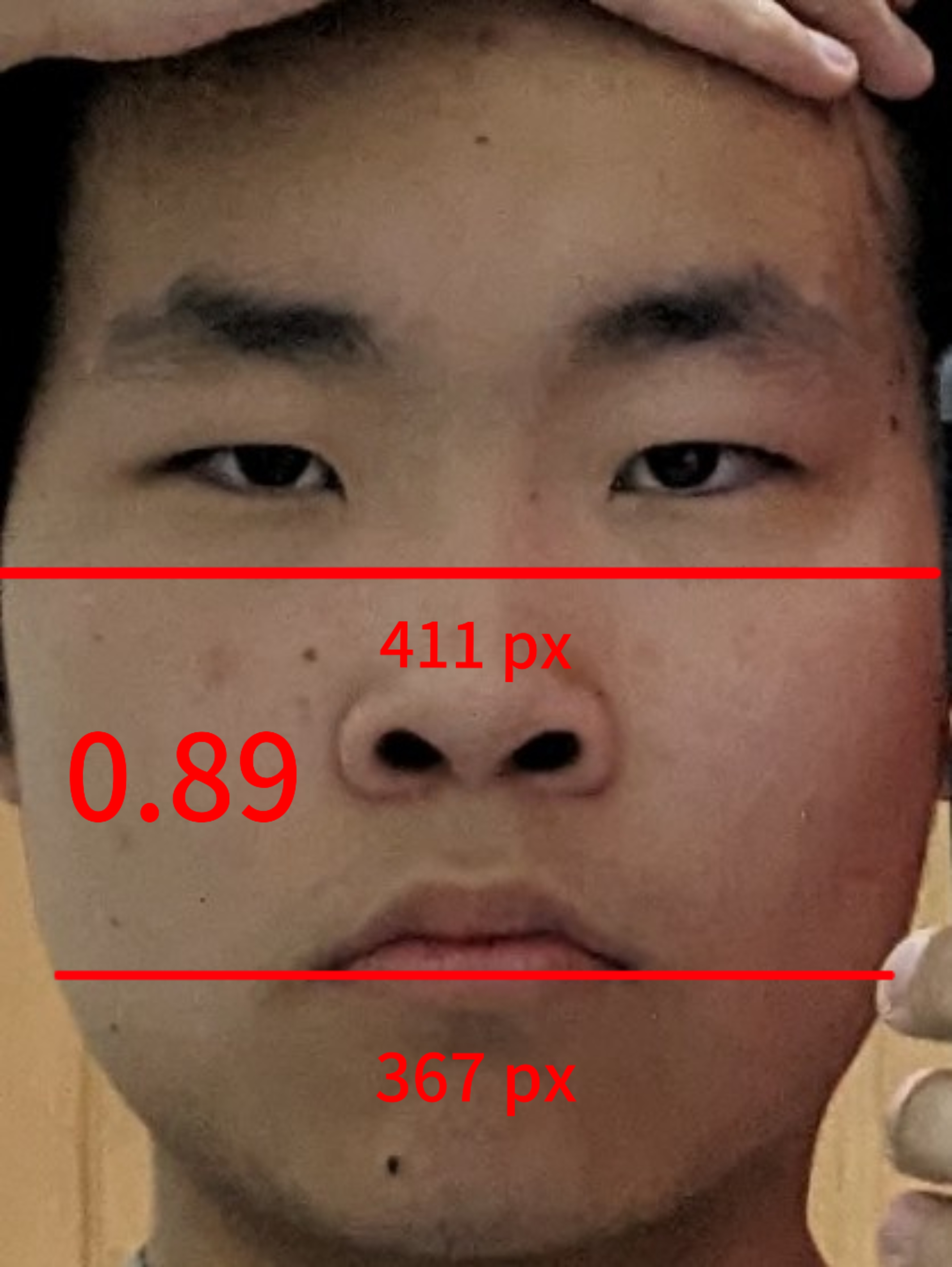 1000003260