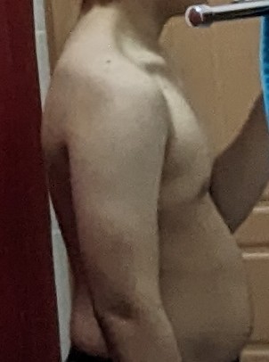 1000003395