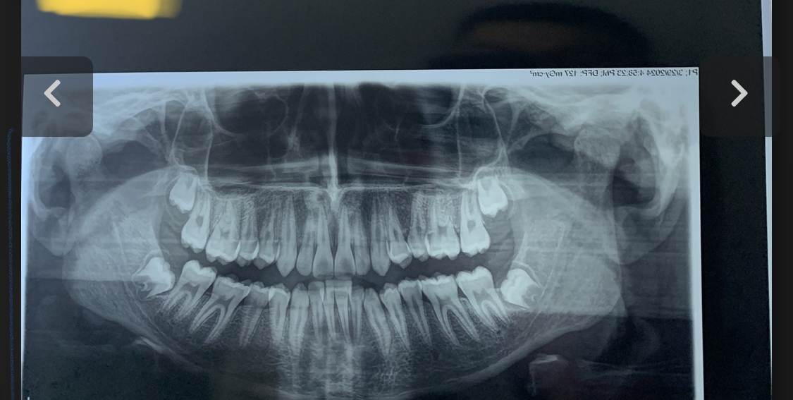 962958E0 E72D 45D2 ADEB 9EDF5DE1E5DF