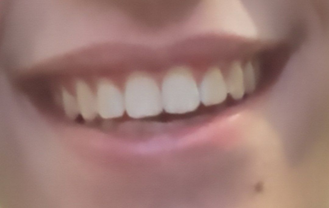 1000014083