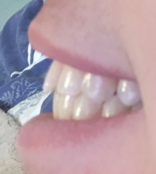 1000014085