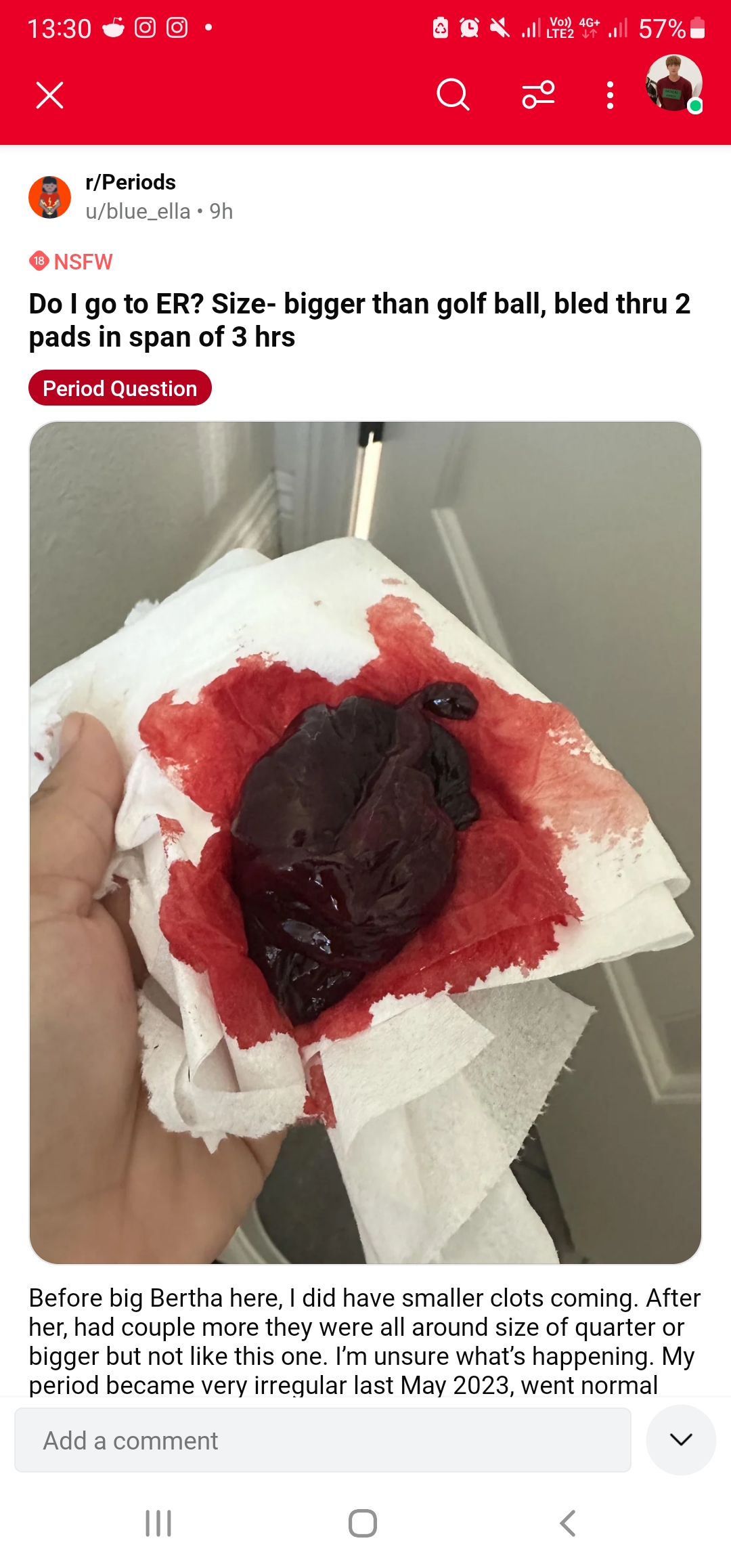 Screenshot 20240511 133008 Reddit