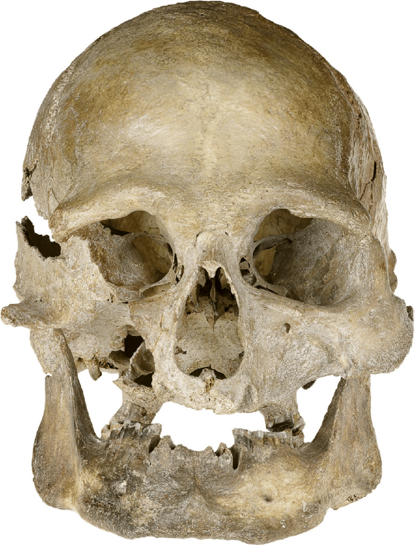 Skull of the Oberkassel male J Vogel LVR LandesMuseum Bonn