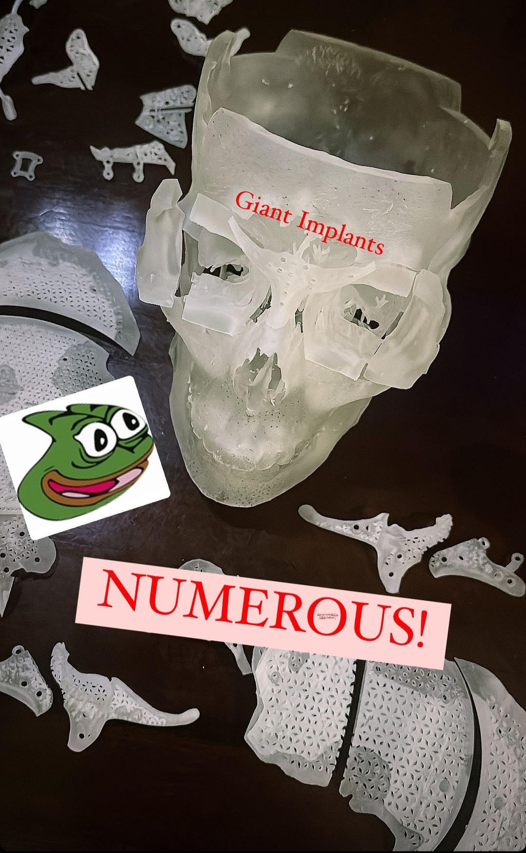 1000003431