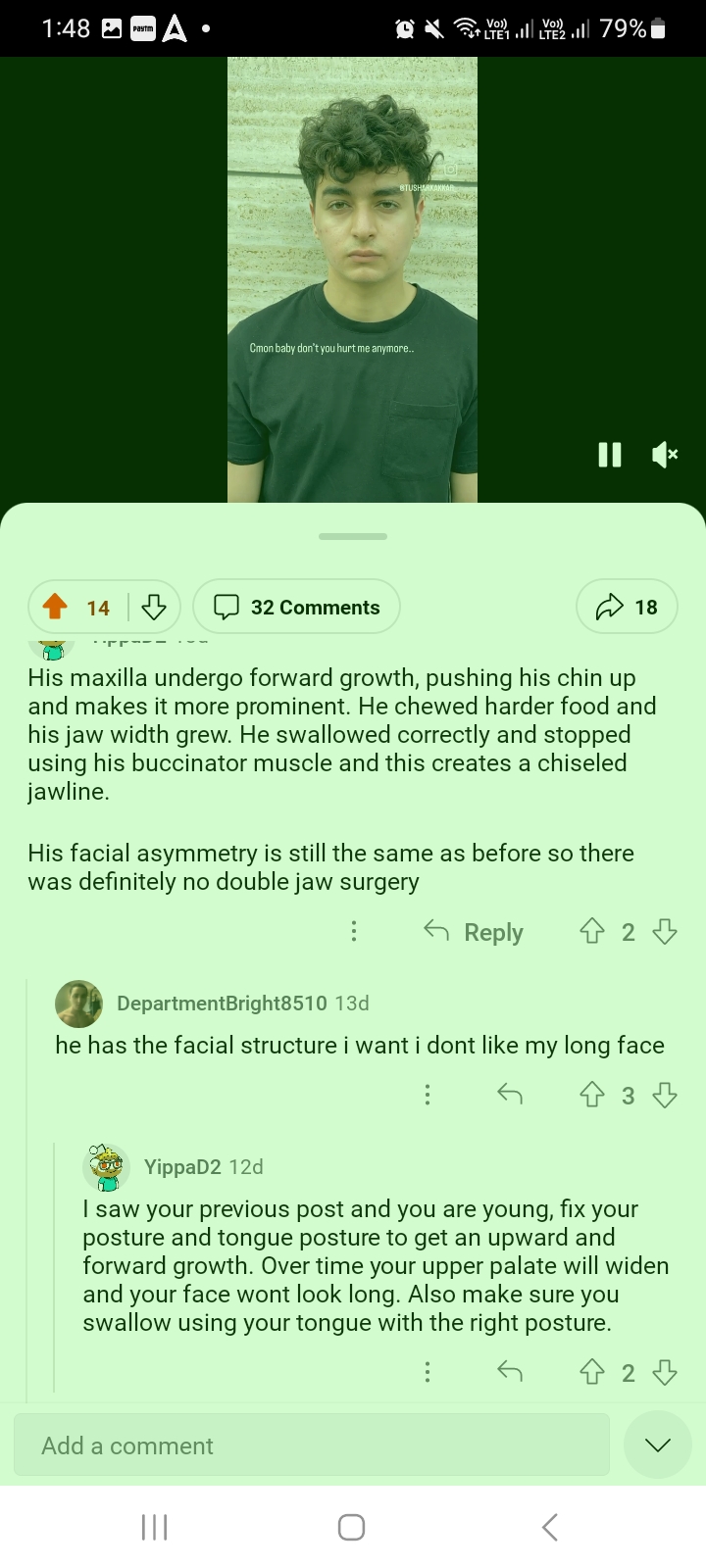 Screenshot 20240513 134800 Reddit Screenshot 20240513 134800 Reddit