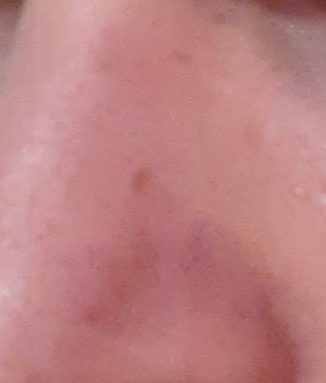 1000060614