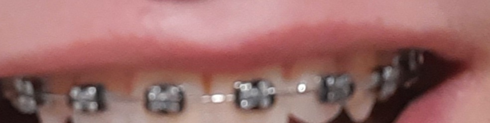 1000060629