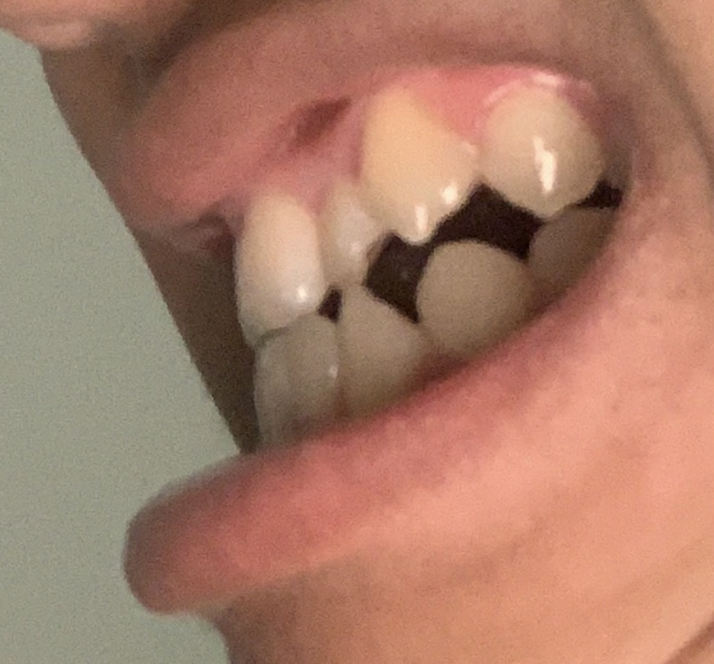 IMG 2601