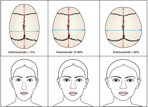 Cephalic index 1