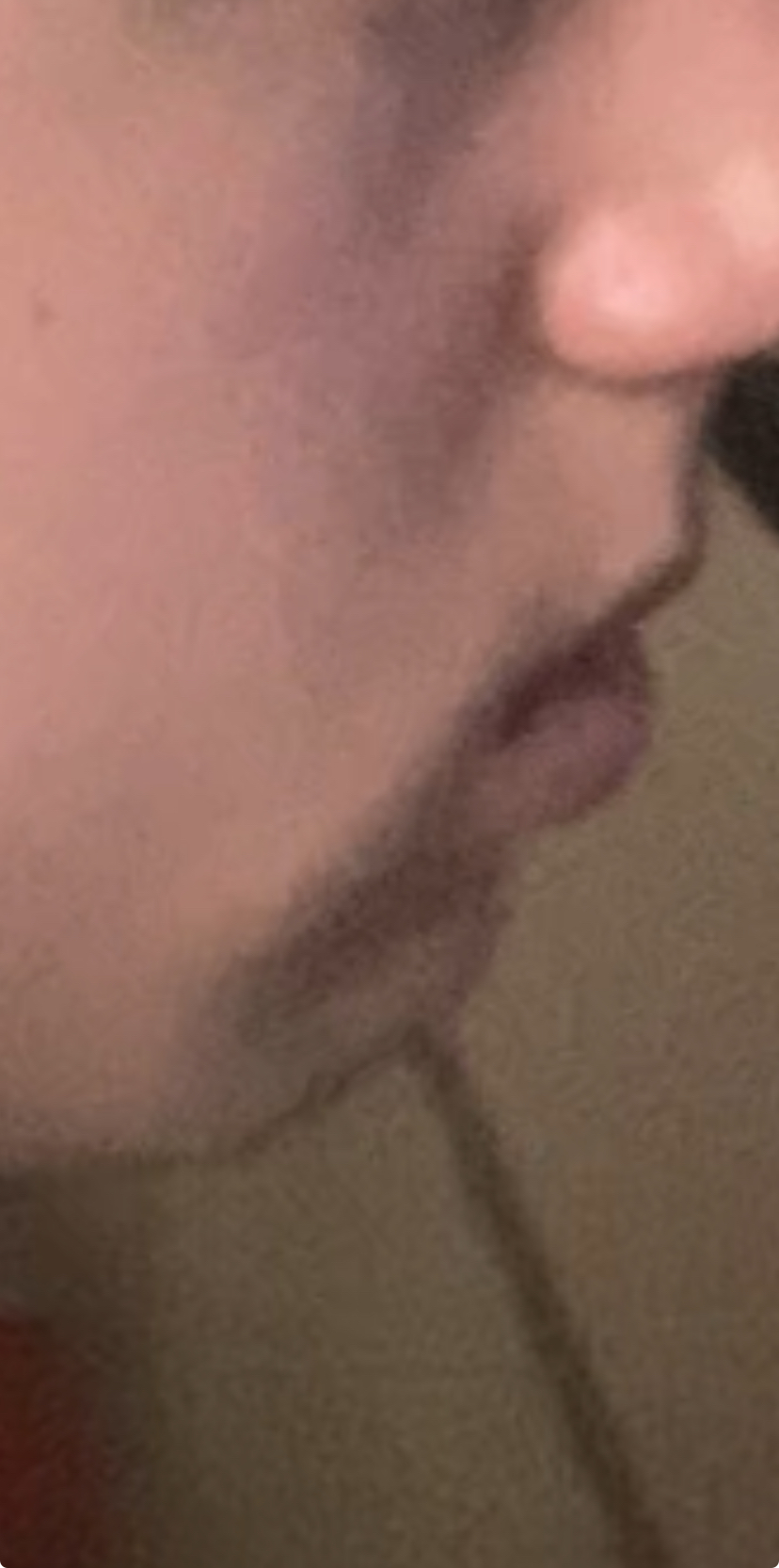 IMG 2849