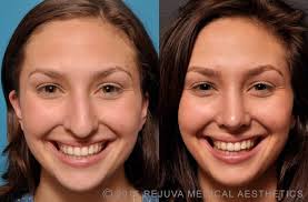 D0E6187C F899 4A6C A683 653CD109C471