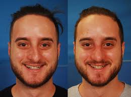 58568645 C080 4B3B 9191 CF3FA073B2FE