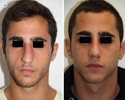 EDBF7F31 48AB 4B43 B4C3 57B54F9D7A93