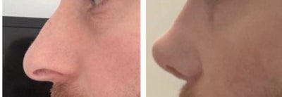 Userimage b6589dc3 34fa 4f20 8147 d7c5c37e7a61