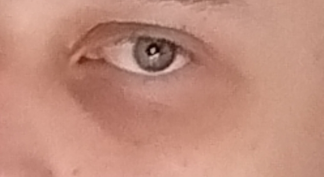 1000194215