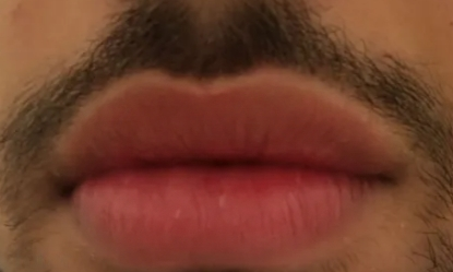 lip-transformed.png