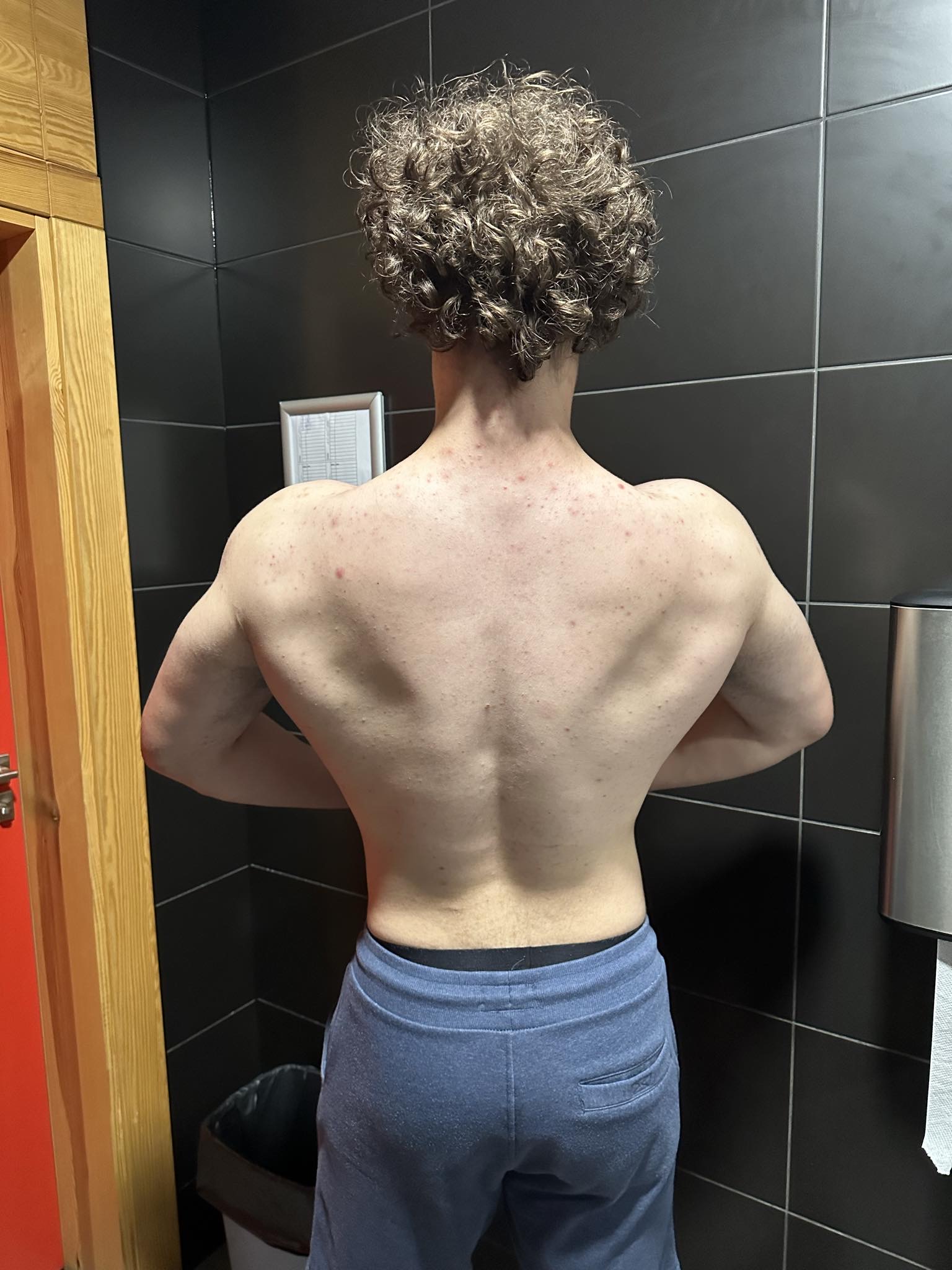 C871CE1D 58E1 4E19 A1C1 71EB38C0BC98