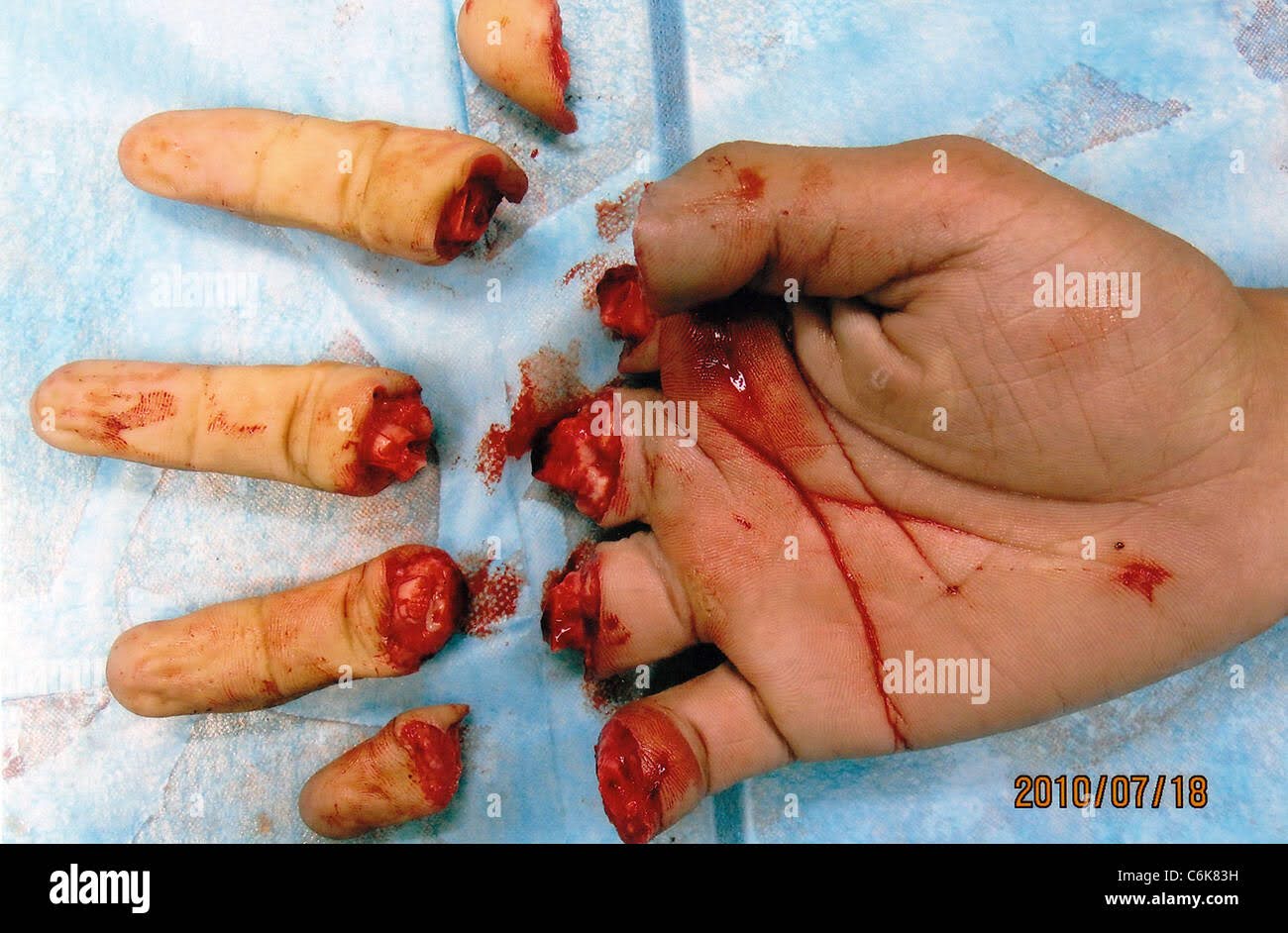 6612D362 58AB 402E ABAC C4A967392DA9