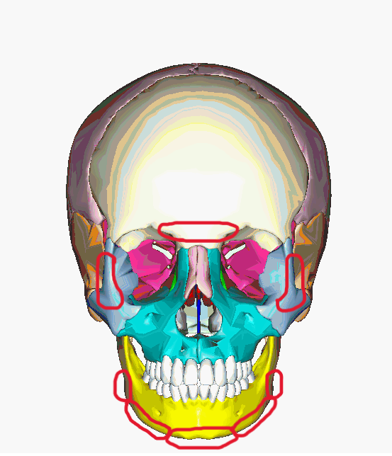 Craniofacial Bones Front View Marked Craniofacial Bones Front View Marked