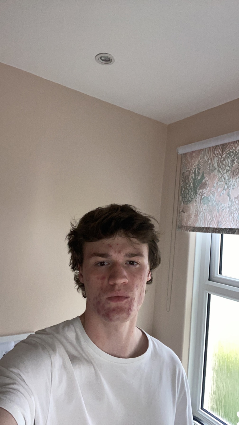IMG 2715