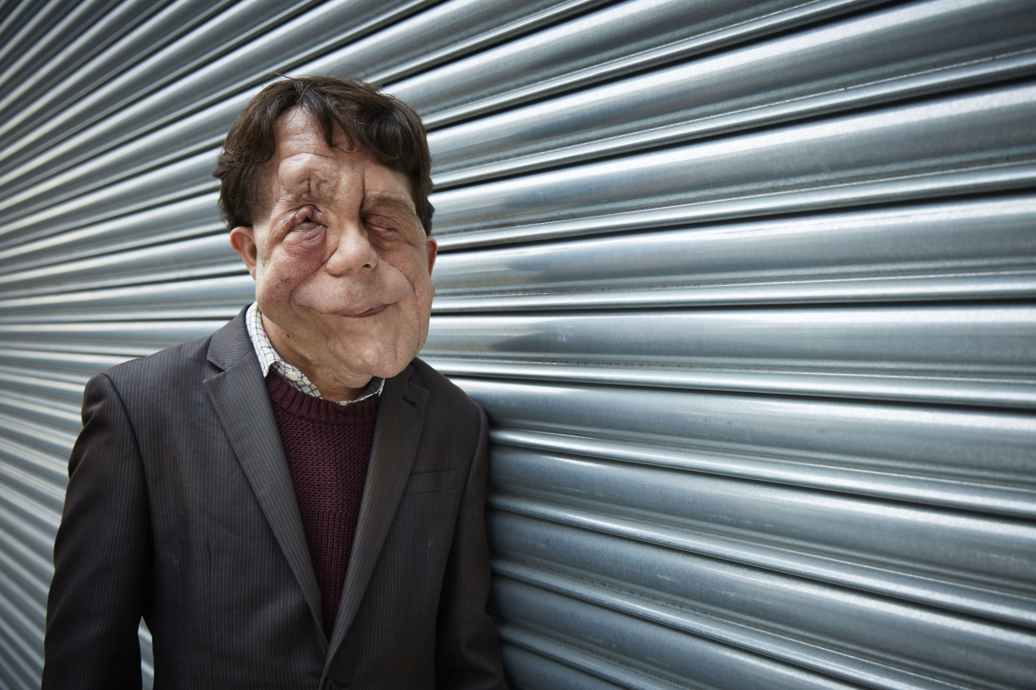 8864693 high res the ugly face of disability hate crime