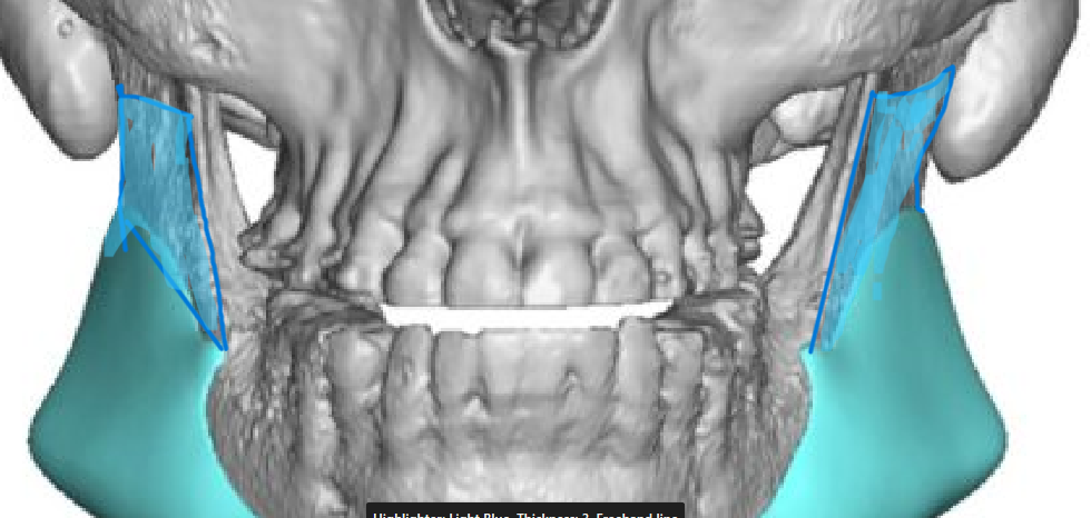 Jaw
