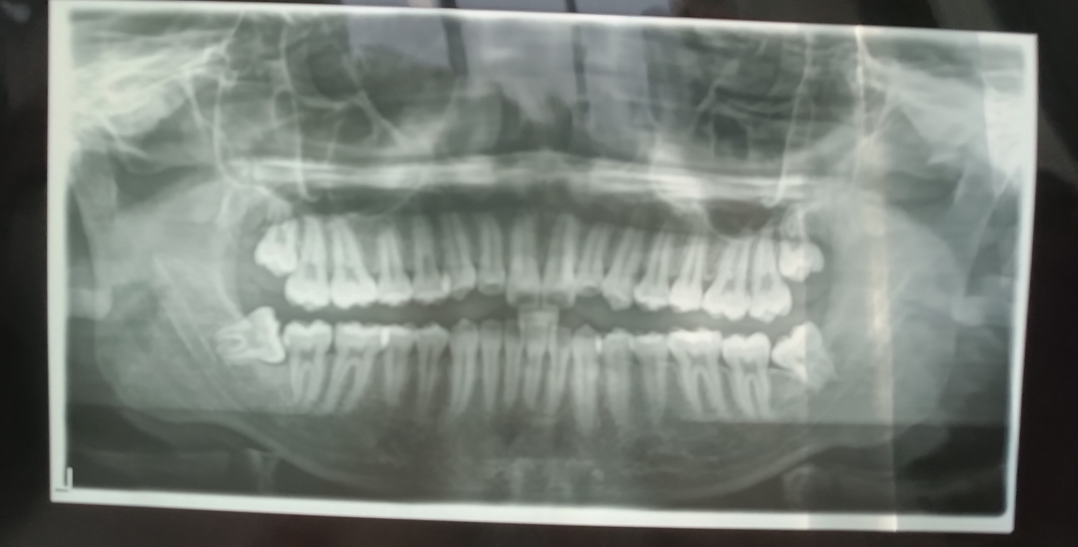 IMG 20240623 085554
