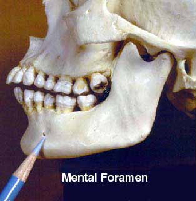 Mental foramen materials for this study The horizontal and vertical diameters of the Mental foramen materials for this study The horizontal and vertical diameters of the