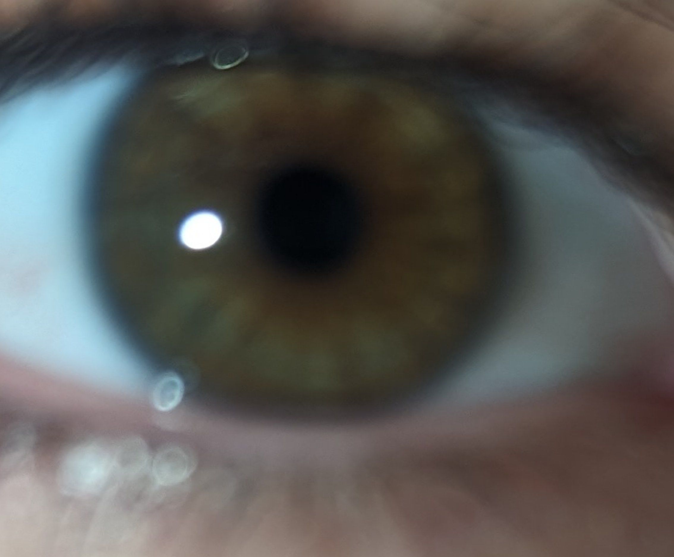 1000020181 1000020181