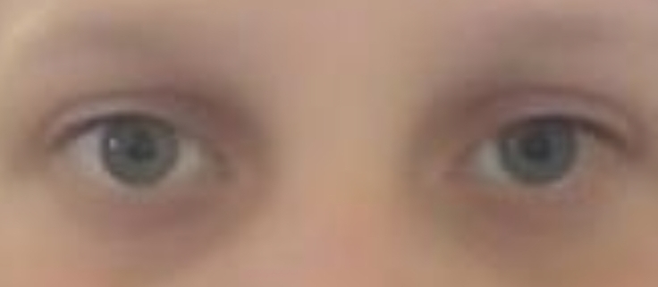 1000195376