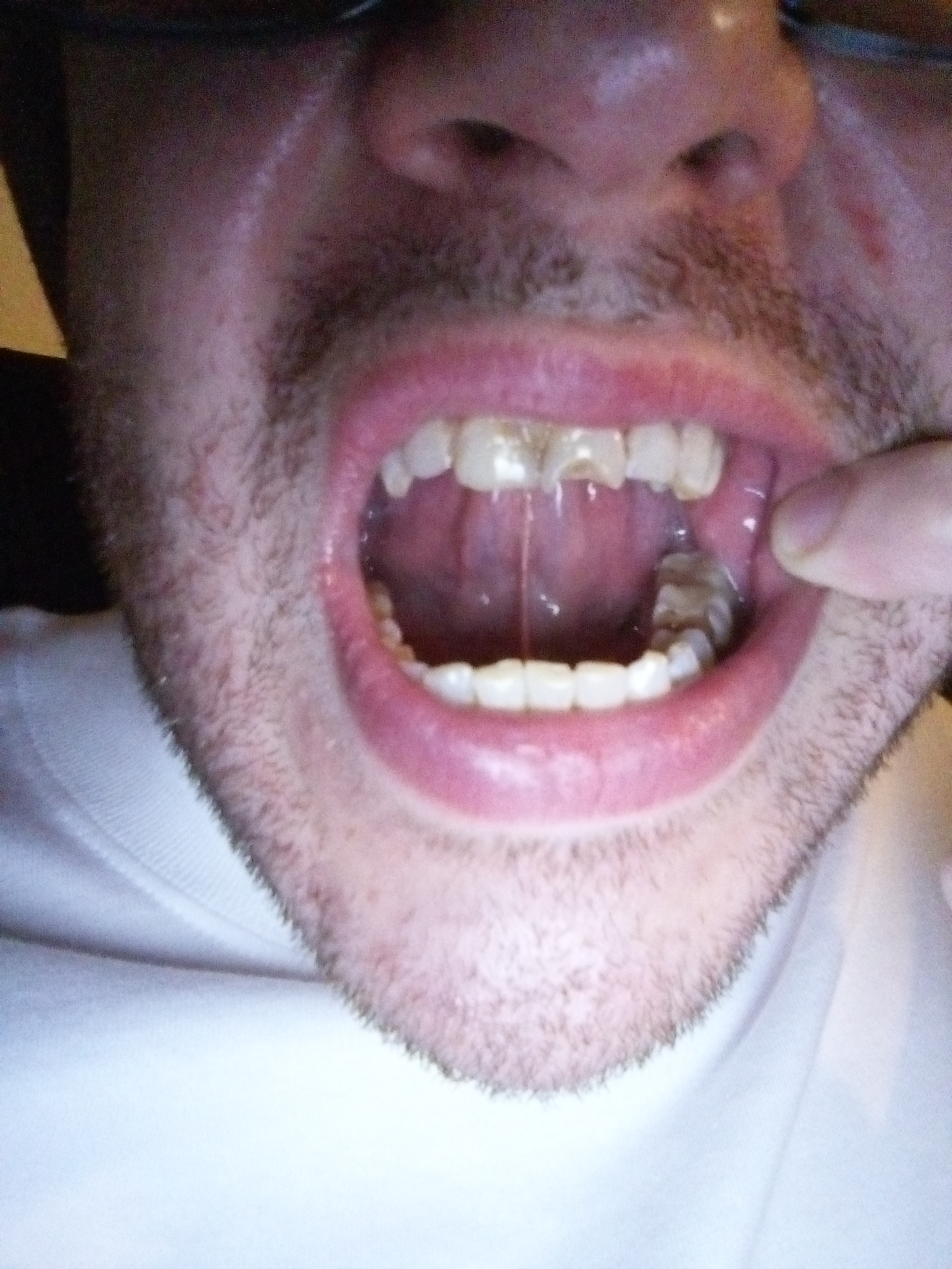 IMG 20240705 121756