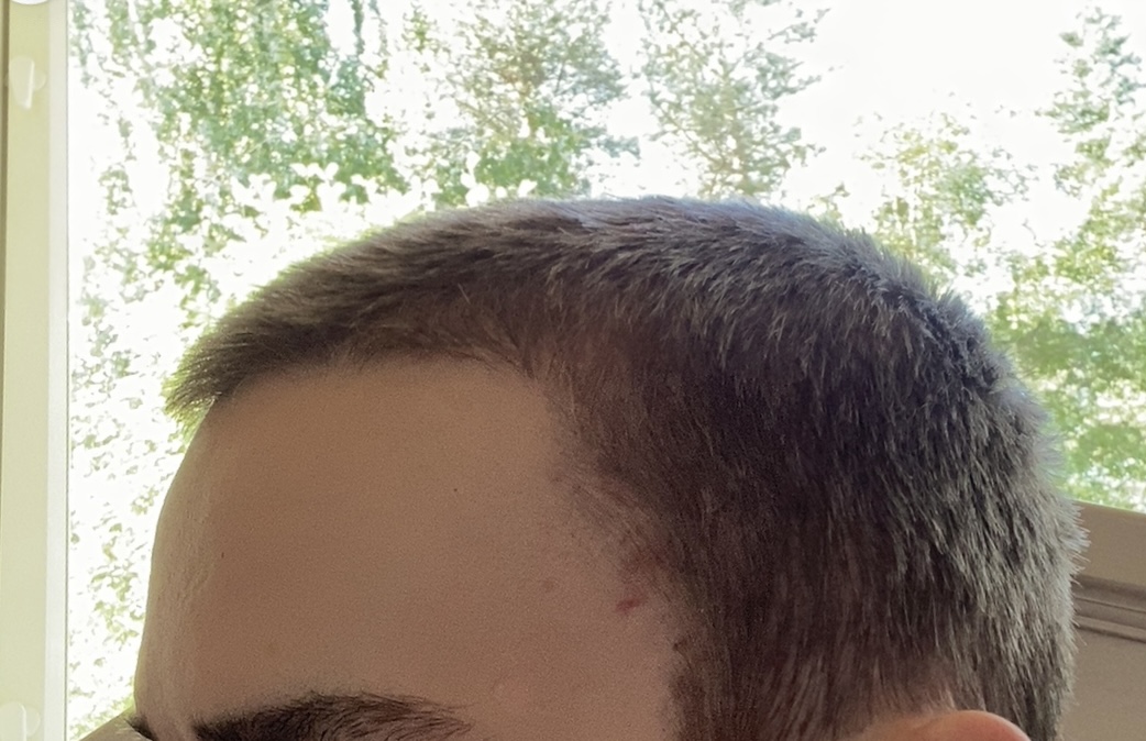 IMG 0532