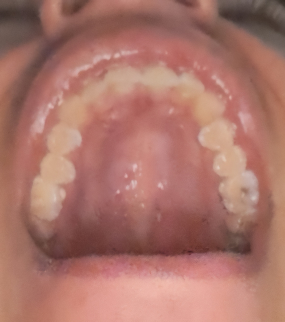 1000009636